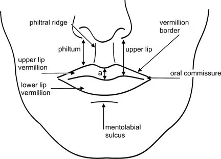 Some thoughts on improving slurs after an embouchure change…